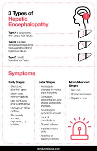 What to Do If You Have Hepatic Encephalopathy - Fatty Liver Disease