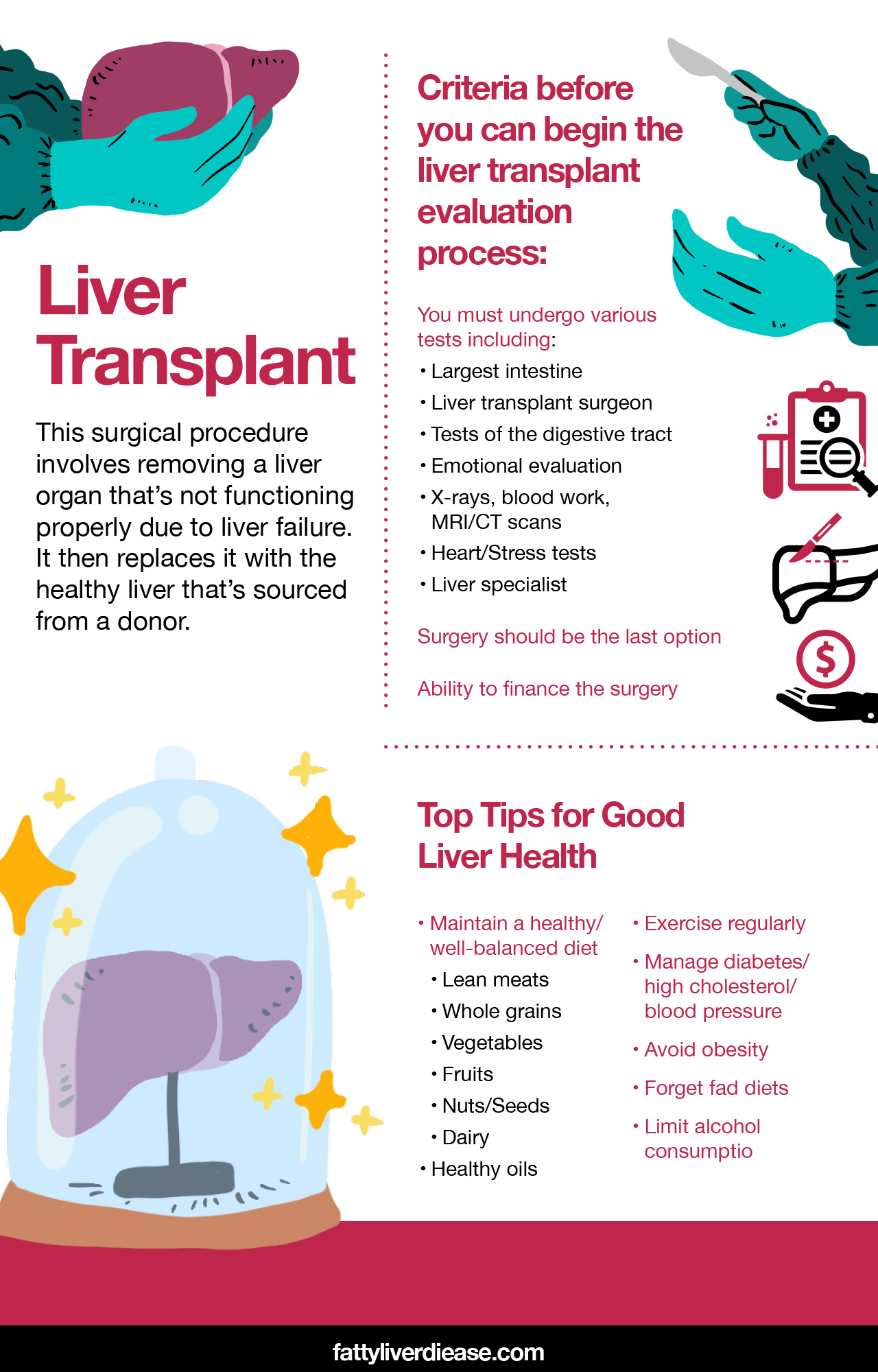 Liver Transplant List of Rules and Requirements