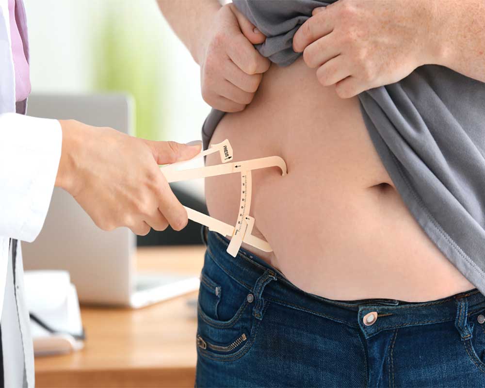 doctor measuring belly fat of patient