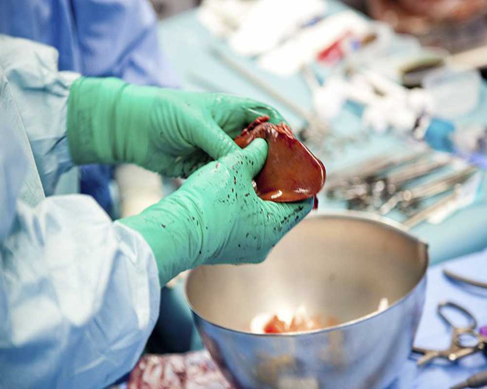 hands with gloves holding a liver for transplant