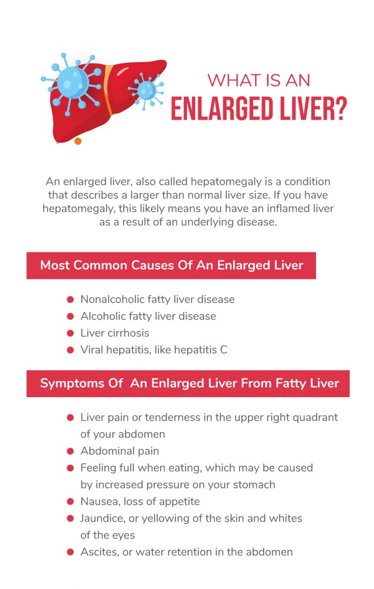 What You Need To Know About An Enlarged Liver - Fatty Liver Disease