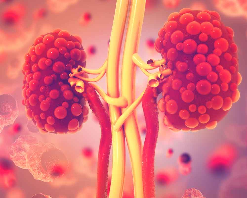 3d ilustration of kidney disease
