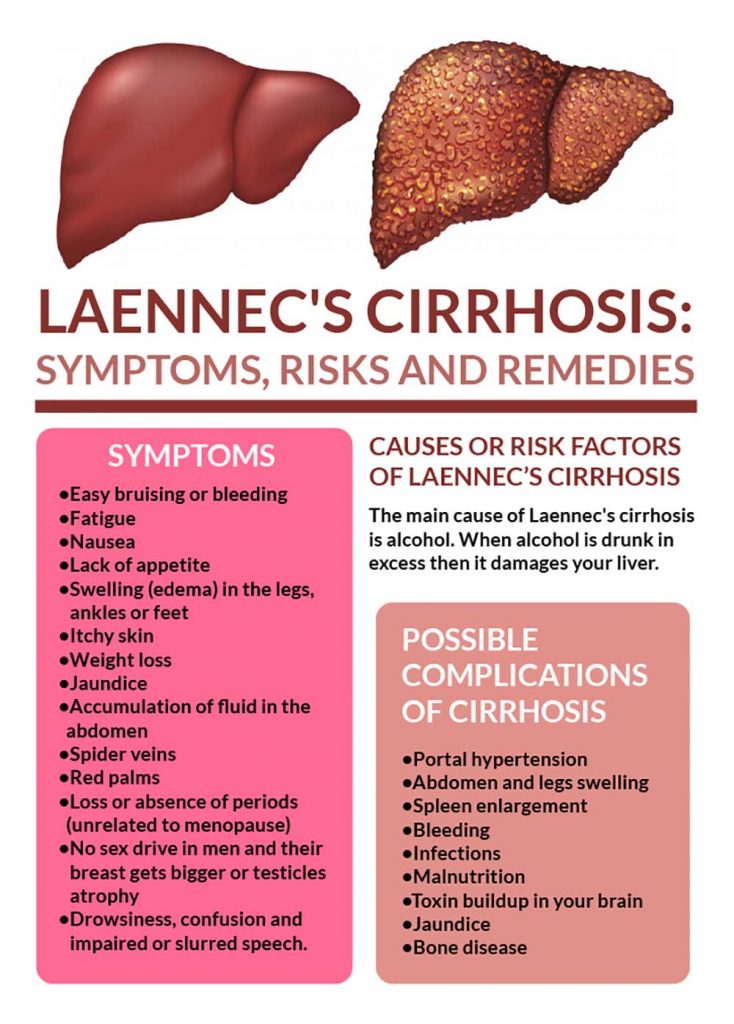 Laennecs Cirrhosis Signs Risks And Remedies Fatty Liver Disease 2198