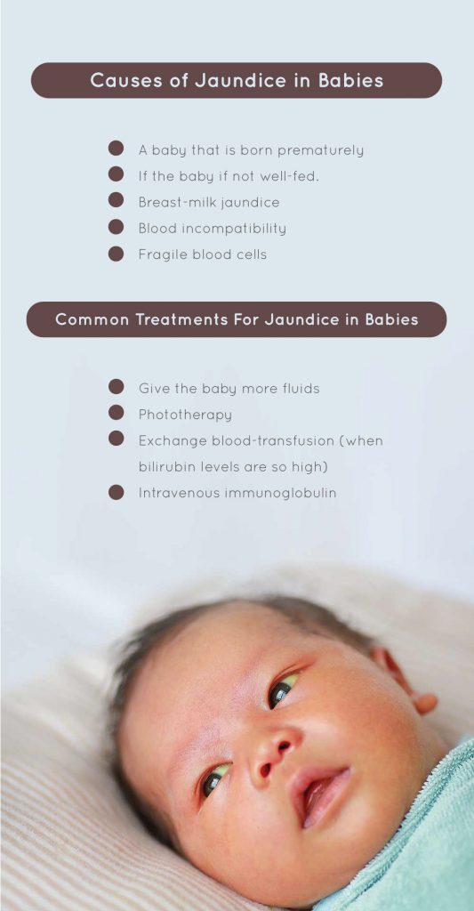 How To Treat Jaundice In Babies Fatty Liver Disease