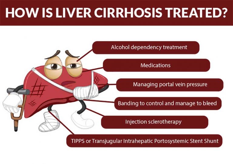 Cirrhosis Complications Prevention And Treatment Fatty Liver Disease