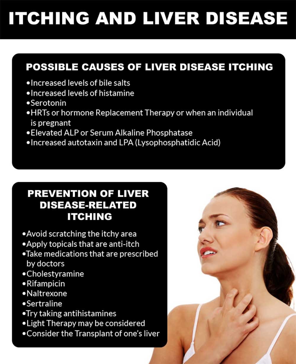 Itching And Liver Disease