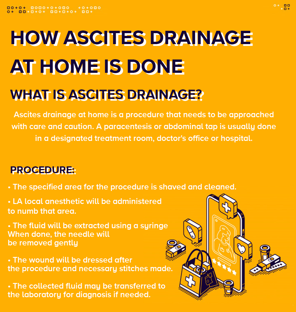 How Ascites Drainage At Home Is Done