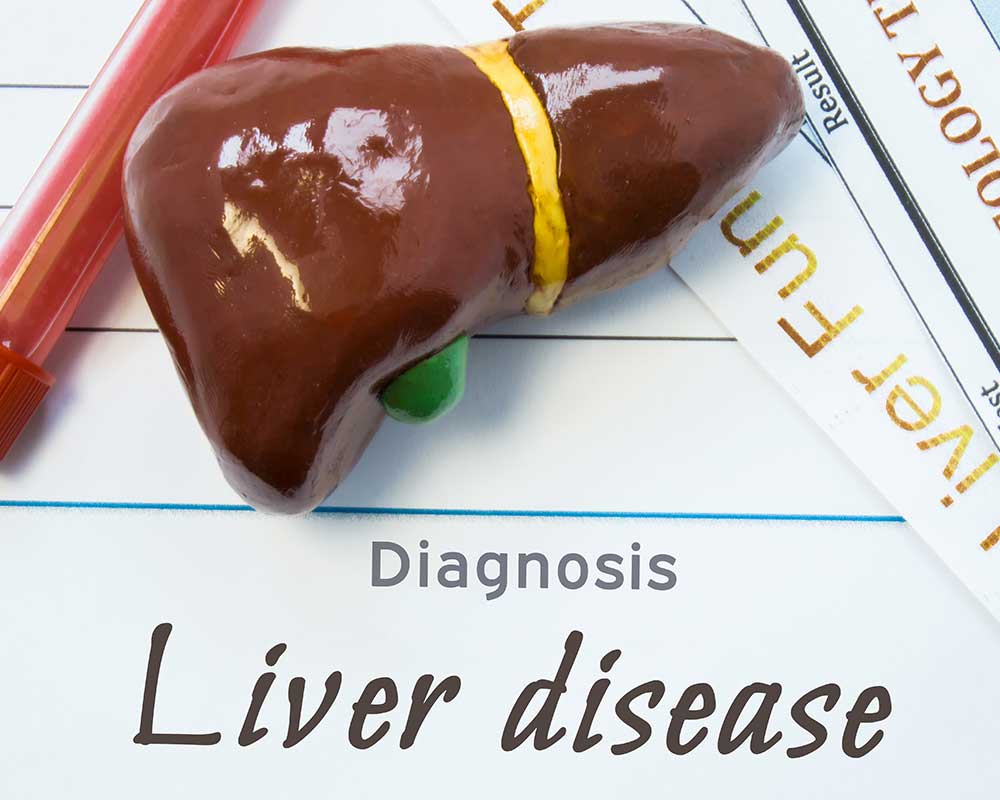 Diagnosis liver dissease text and a human liver with yellow ribbon