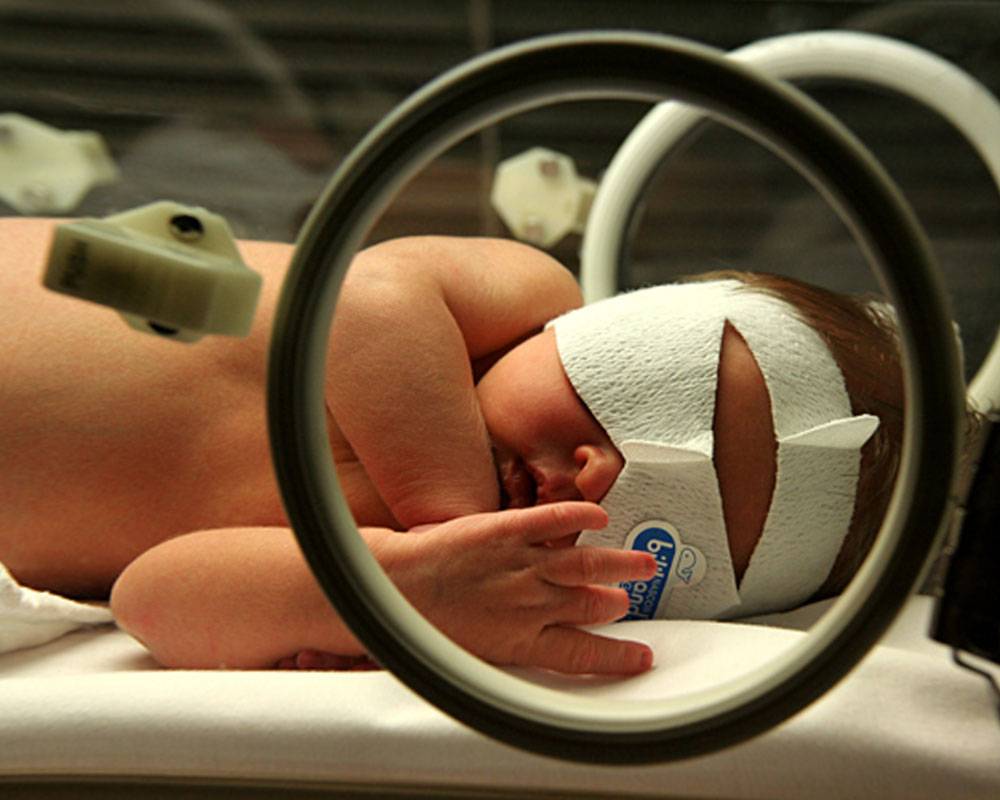 phototherapy for neonatal jaundice