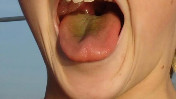 child sticking tongue out