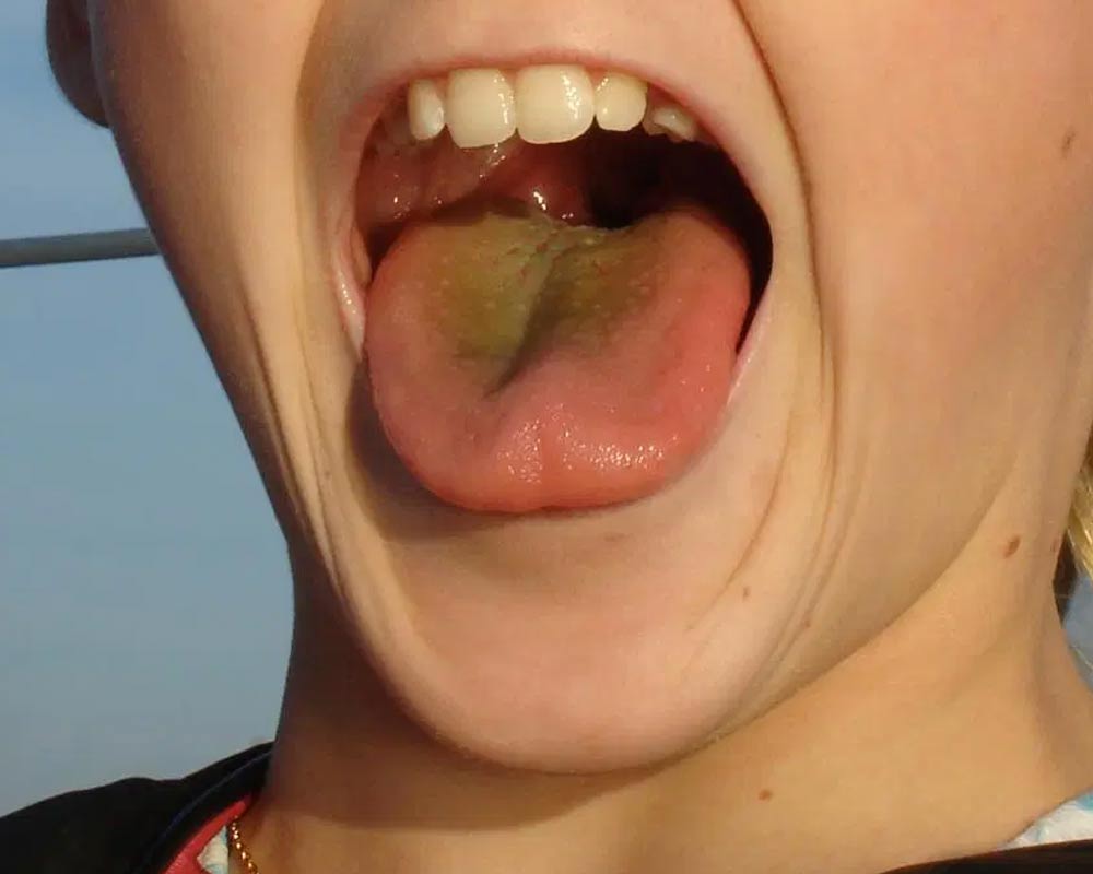 child sticking tongue out