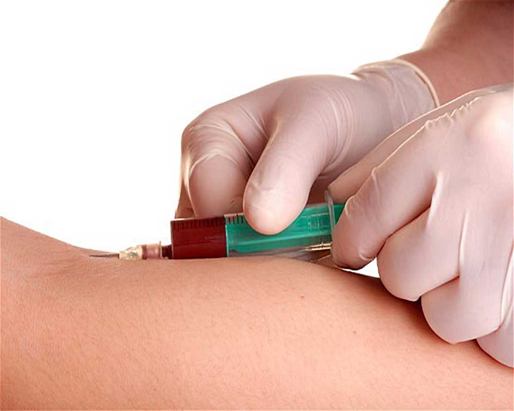 syringe inserted on skin for blood sample