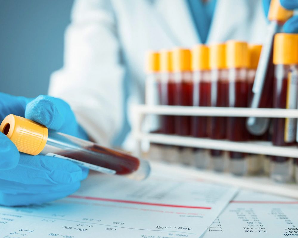 Physician holding blood samples in test tubes