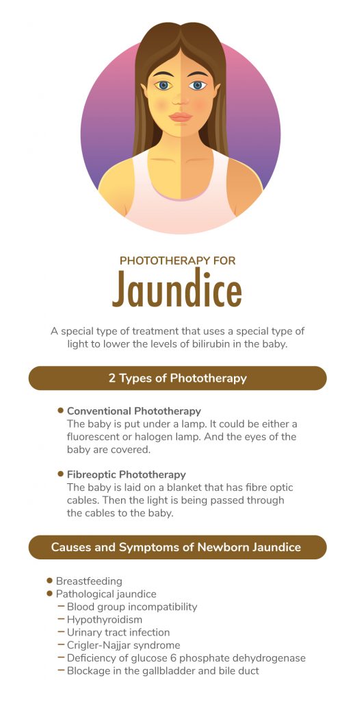 Is Phototherapy For Jaundice Effective?  Fatty Liver Disease