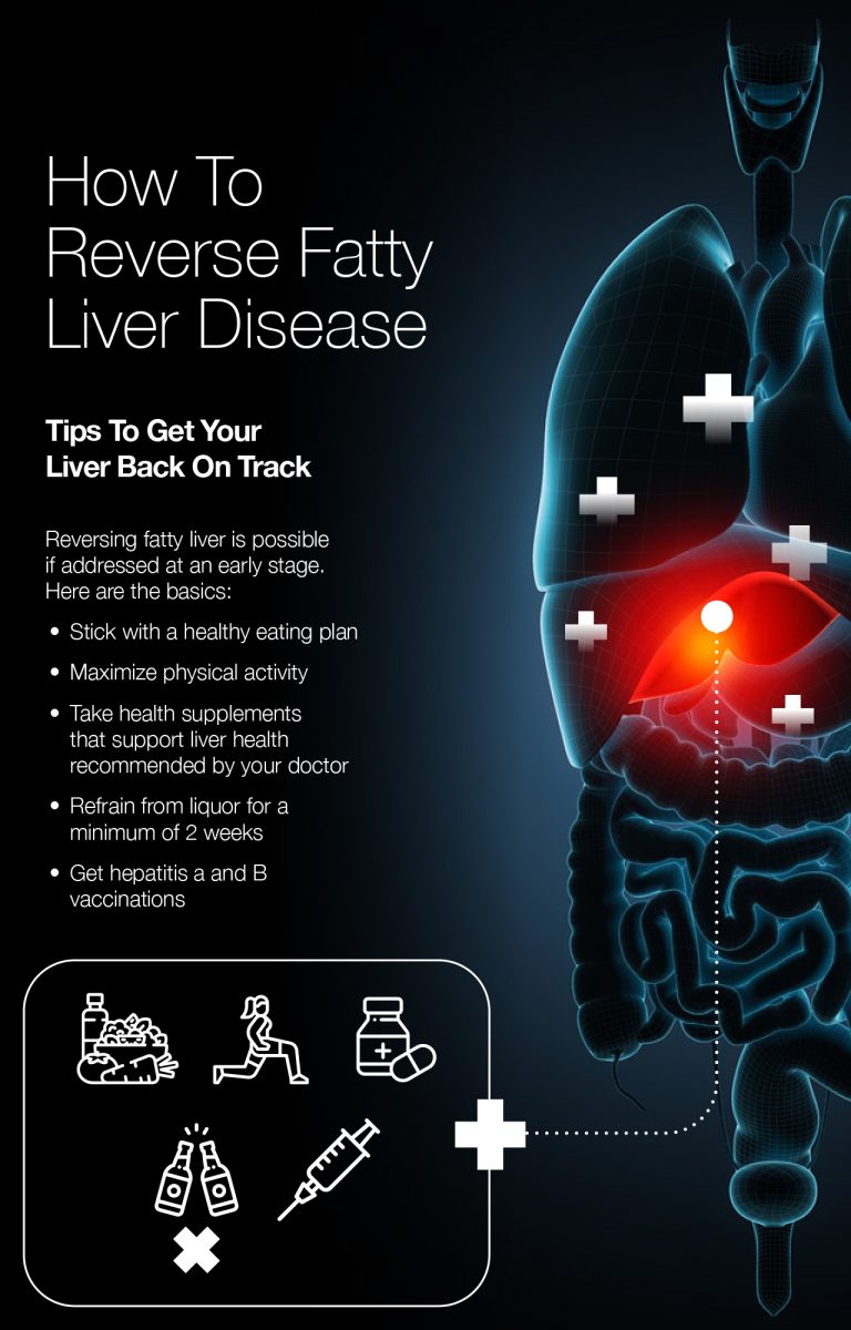 Reversing Fatty Liver Disease: NAFLD and AFLD | FattyLiverDisease