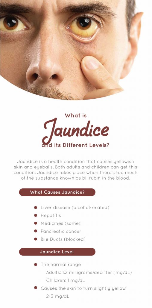 What Is Jaundice And Its Different Levels Fatty Liver Disease 8451