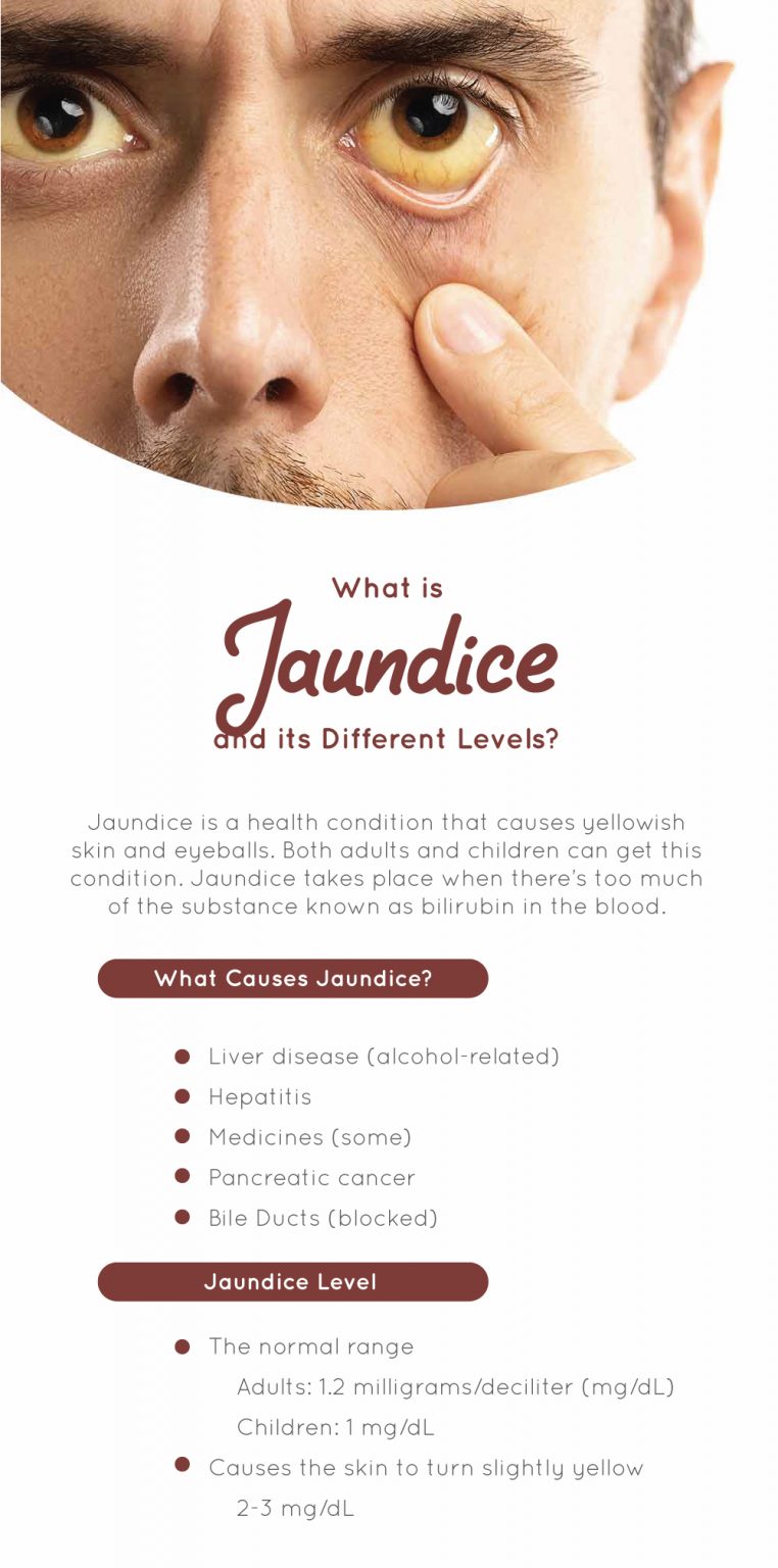 What Is Jaundice And Its Different Levels Fatty Liver Disease