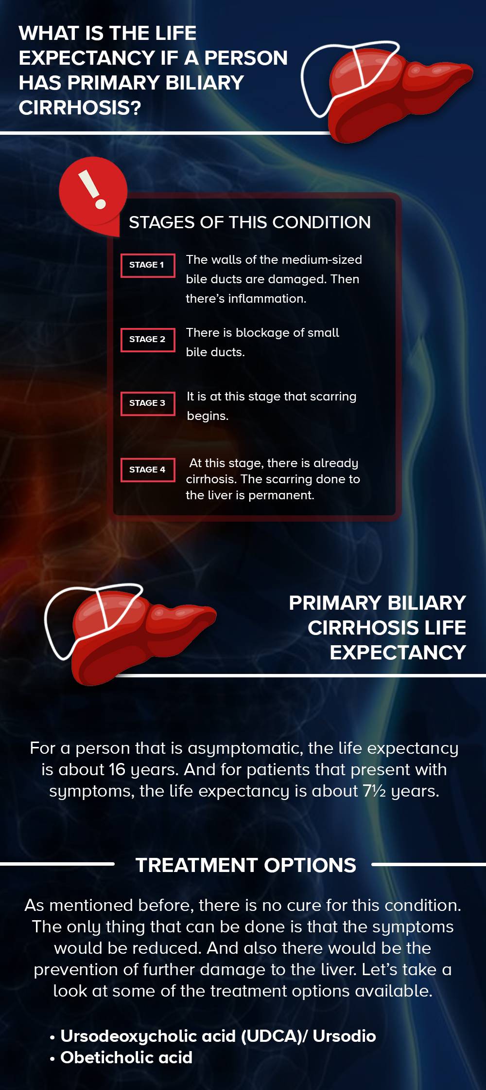 primary biliary cirrhosis life expectancy