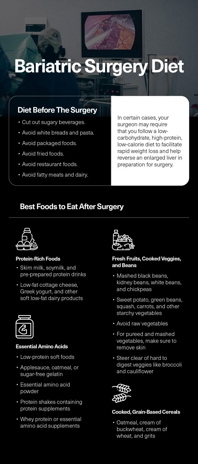 Bariatric Surgery Diet: Before And After | Fatty Liver Disease