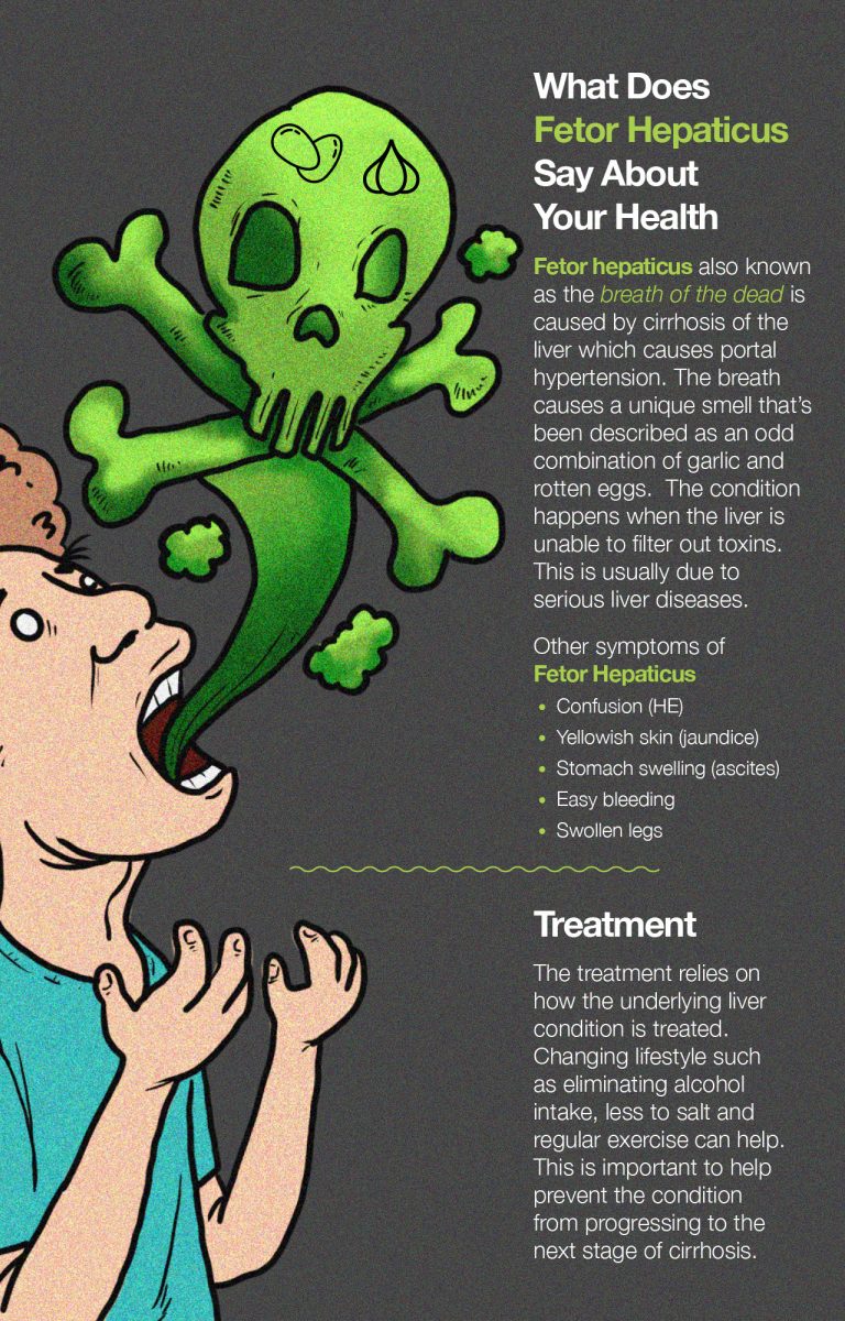 Cirrhosis And Bad Breath What Is Fetor Hepaticus Fatty Liver Disease