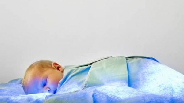 baby on a Fiber-optic phototherapy