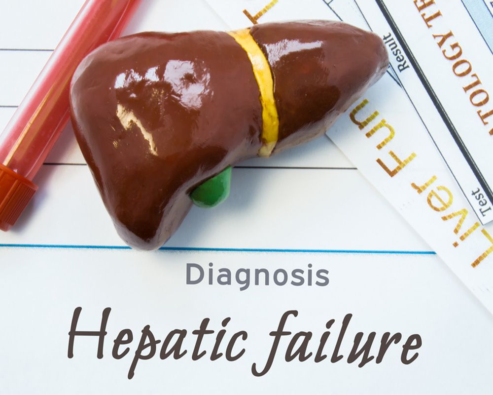 Hepatic Failure