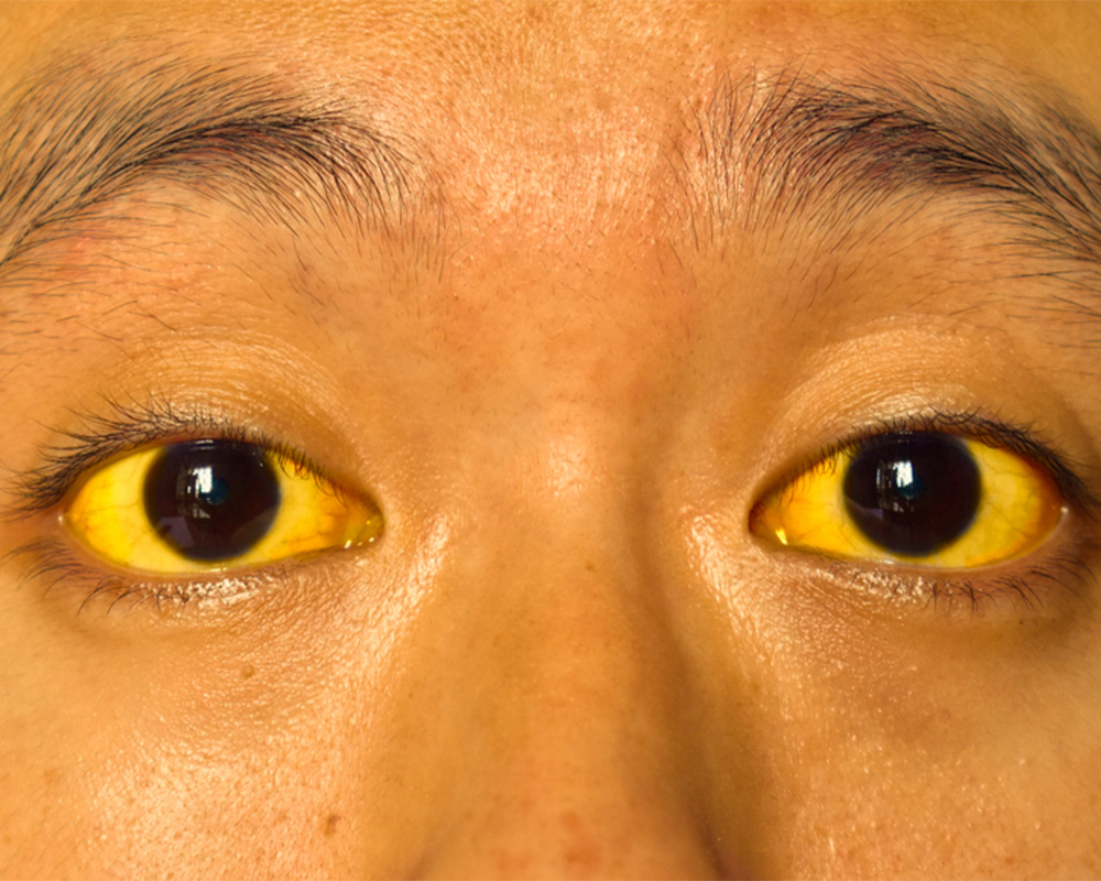 Man with Yellow Eyes