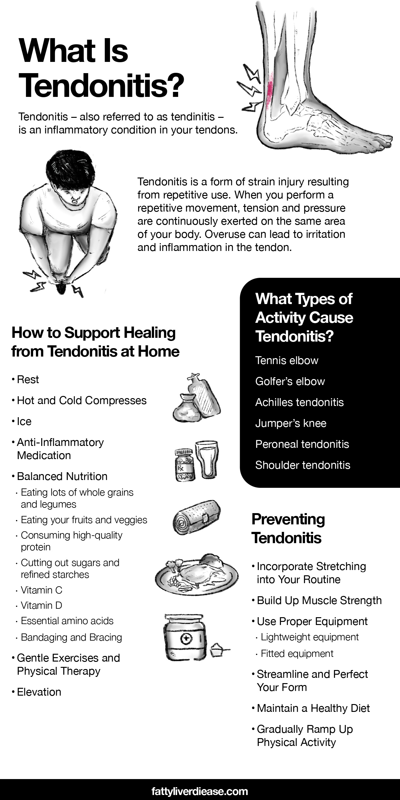 What Is Tendonitis?