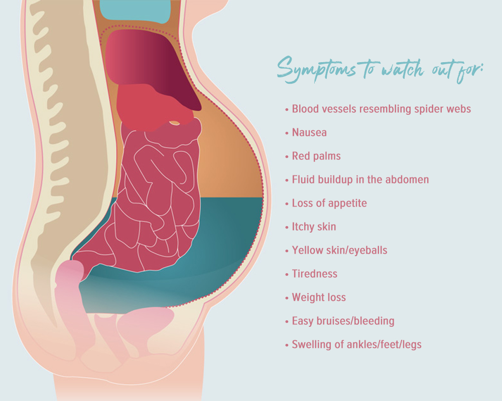 Liver Ascites Symptoms To Watch Out For