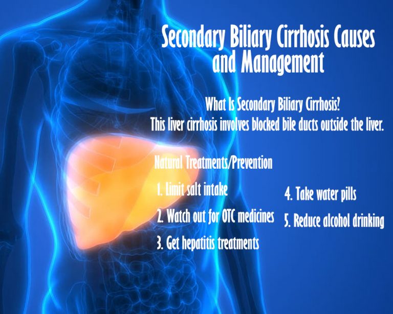 Secondary Biliary Cirrhosis Causes and Management - Fatty Liver Disease