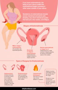 Endometriosis Surgery and How to Support Recovery - Fatty Liver Disease