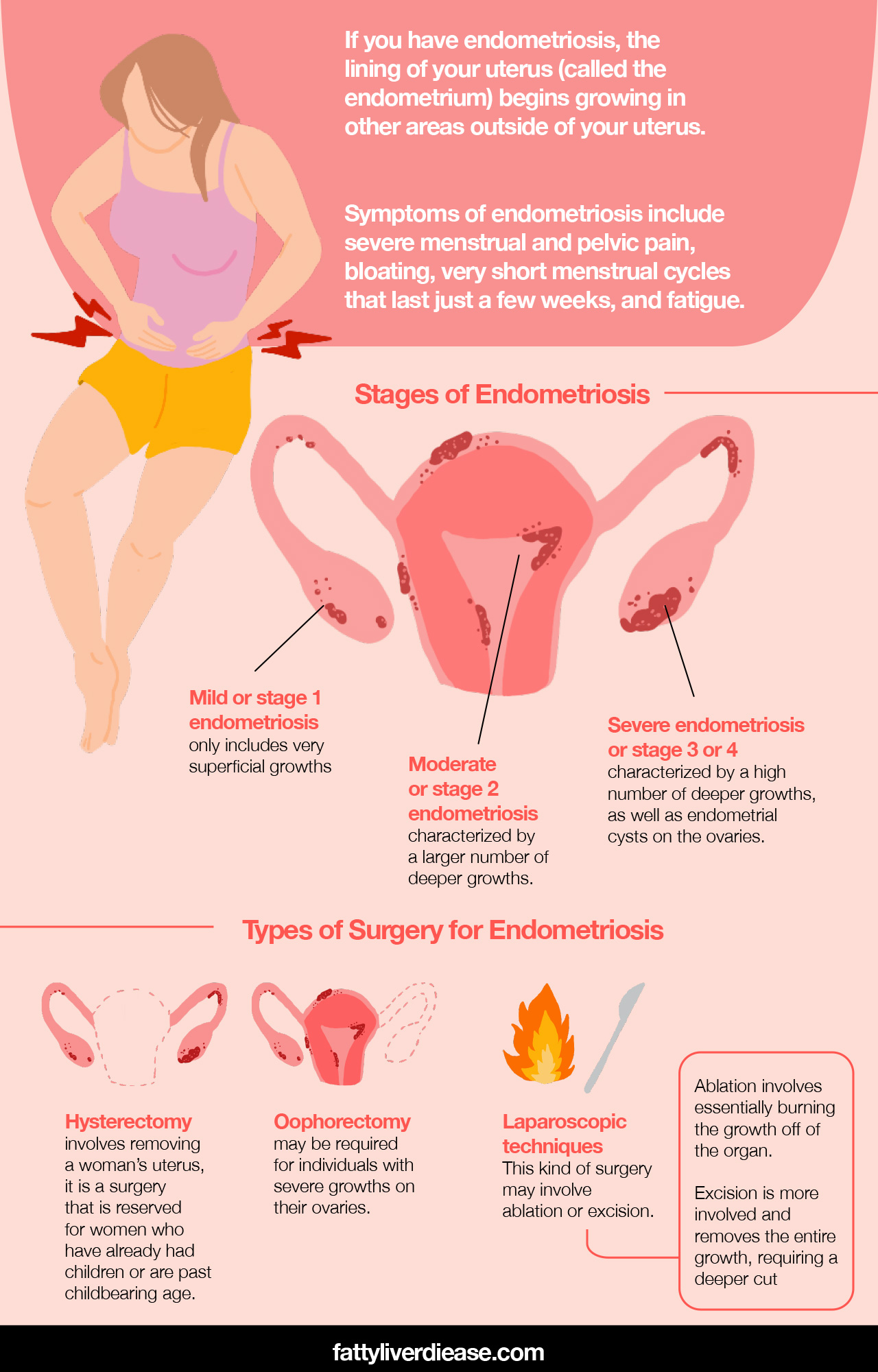 progesterone in treating endo pain