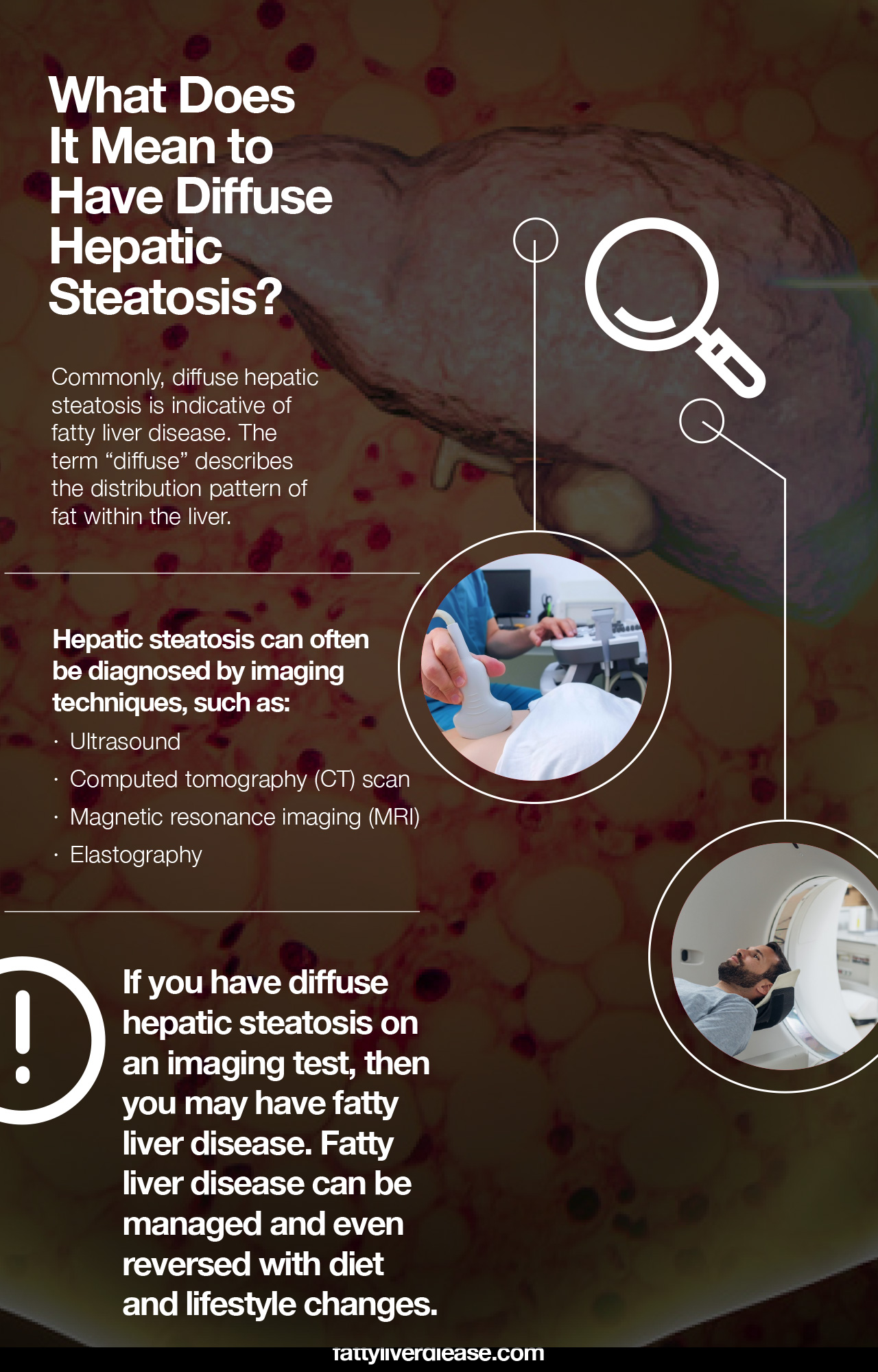 Diffuse Hepatic Steatosis