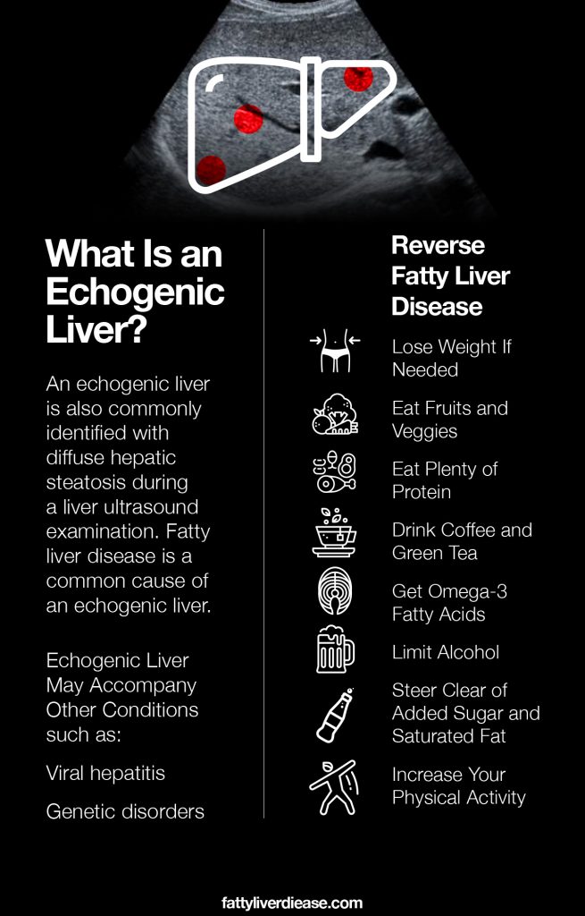 Echogenic Liver: What Does It Mean? | Fatty Liver Disease