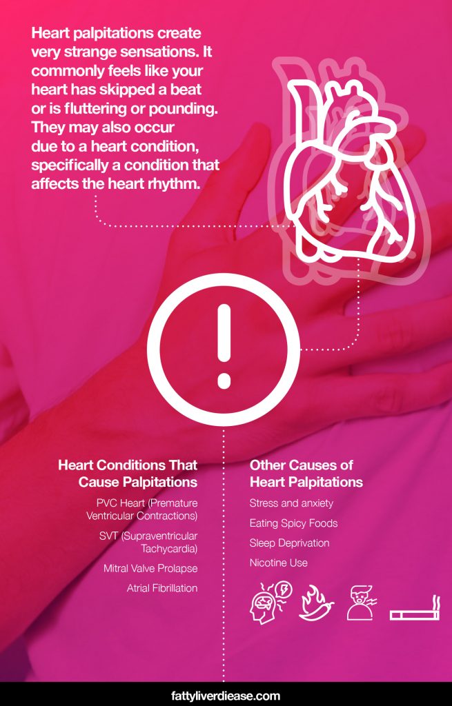 palpitations irregular heartbeat causes