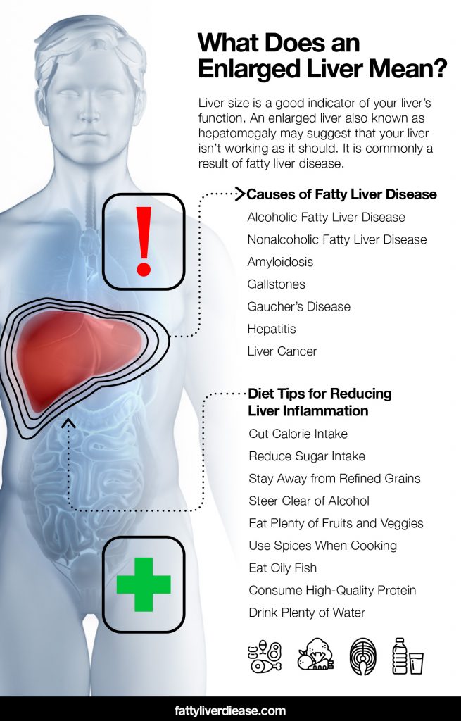 Do You Have A Normal Liver Size Fatty Liver Disease