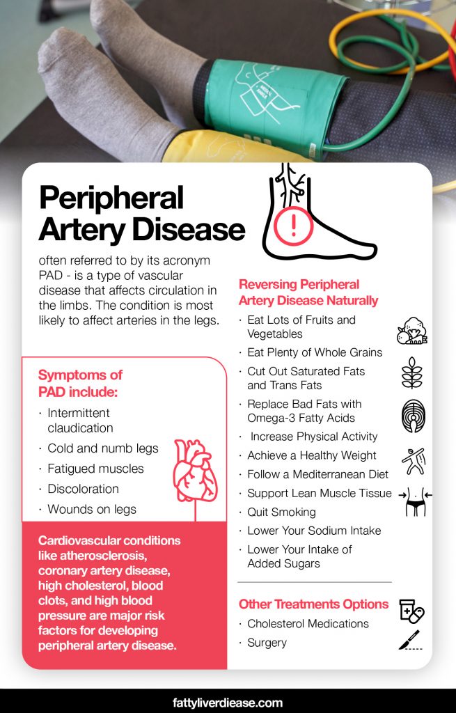 Reversing Peripheral Artery Disease Naturally | Fatty Liver Disease