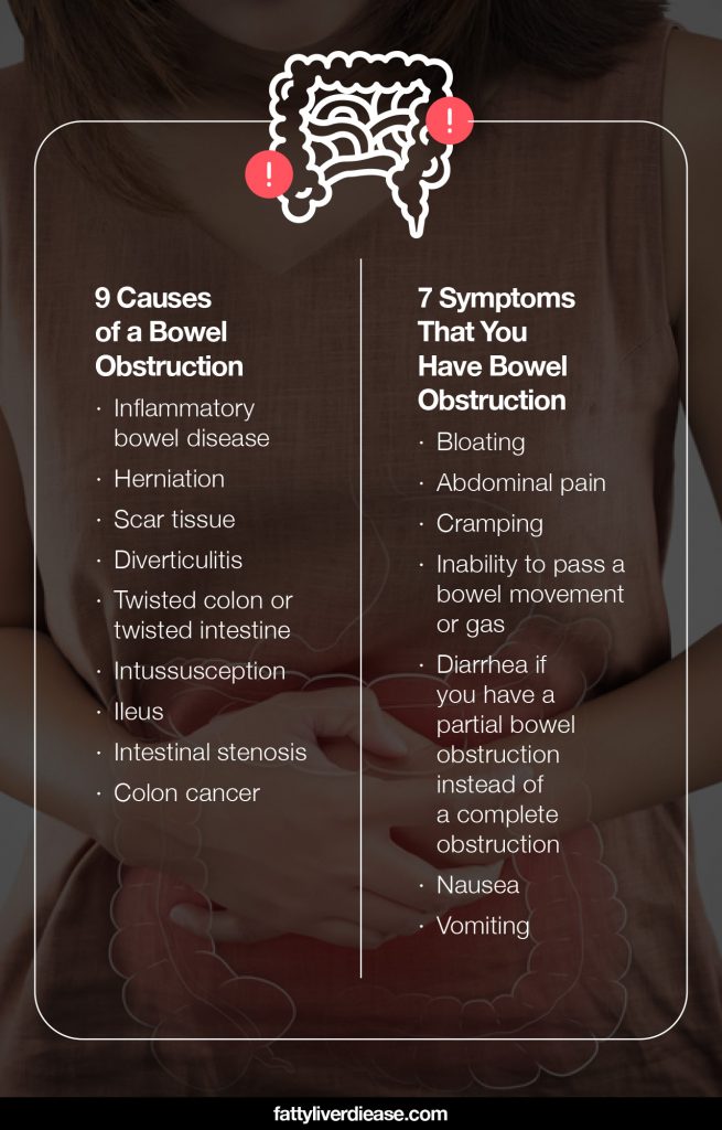 Bowel Obstruction Diet: Foods to Eat and Avoid | Fatty Liver Disease
