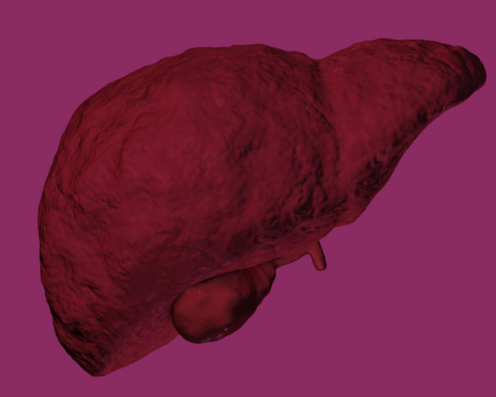 How to Manage Fatty Liver Disease