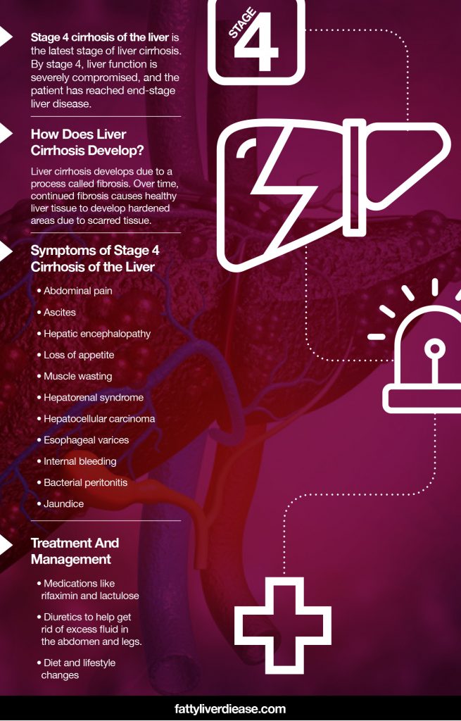 Stage 4 Cirrhosis of the Liver Life Expectancy Fatty Liver Disease