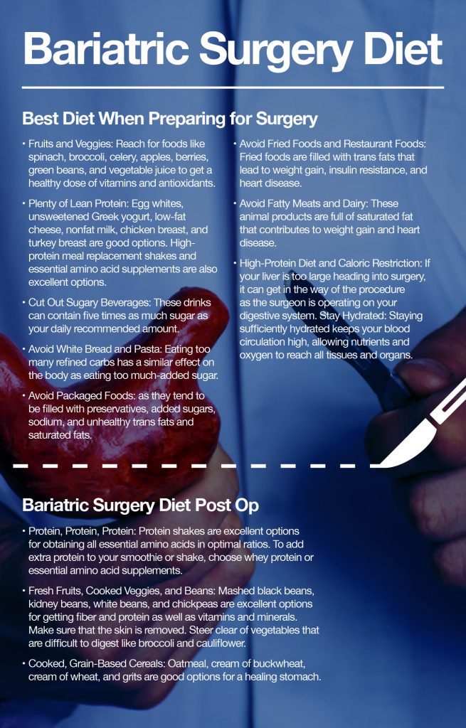 Bariatric Surgery Diet Pre Op And Post Op 